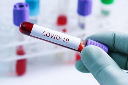 کانادا انجام اولین آزمایشات بالینی واکسن کووید-19 را تایید کرد