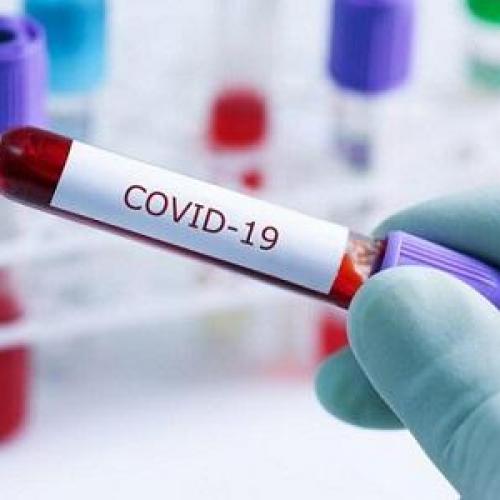 کانادا انجام اولین آزمایشات بالینی واکسن کووید-19 را تایید کرد